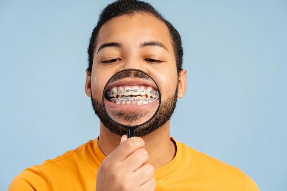 Clear Aligners vs. Traditional Braces: Key Comparisons