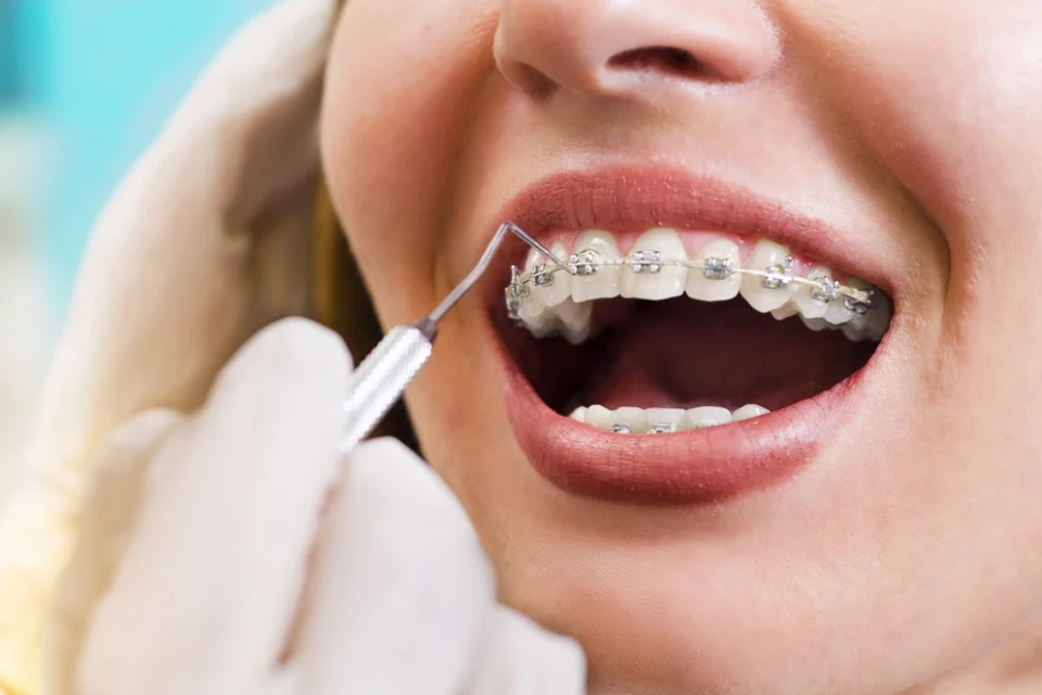 Why Choose Dental Land in Rosedale?​