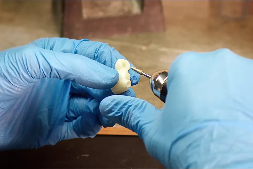 Factors Influencing the Cost Of Dental Bridges