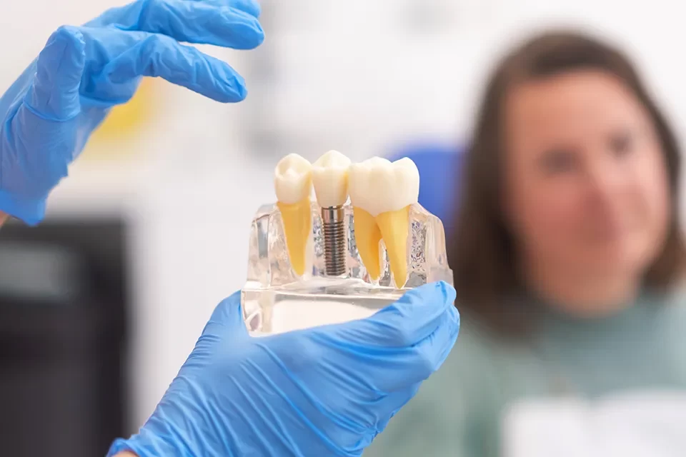 Understanding the Cost Of Dental Implants