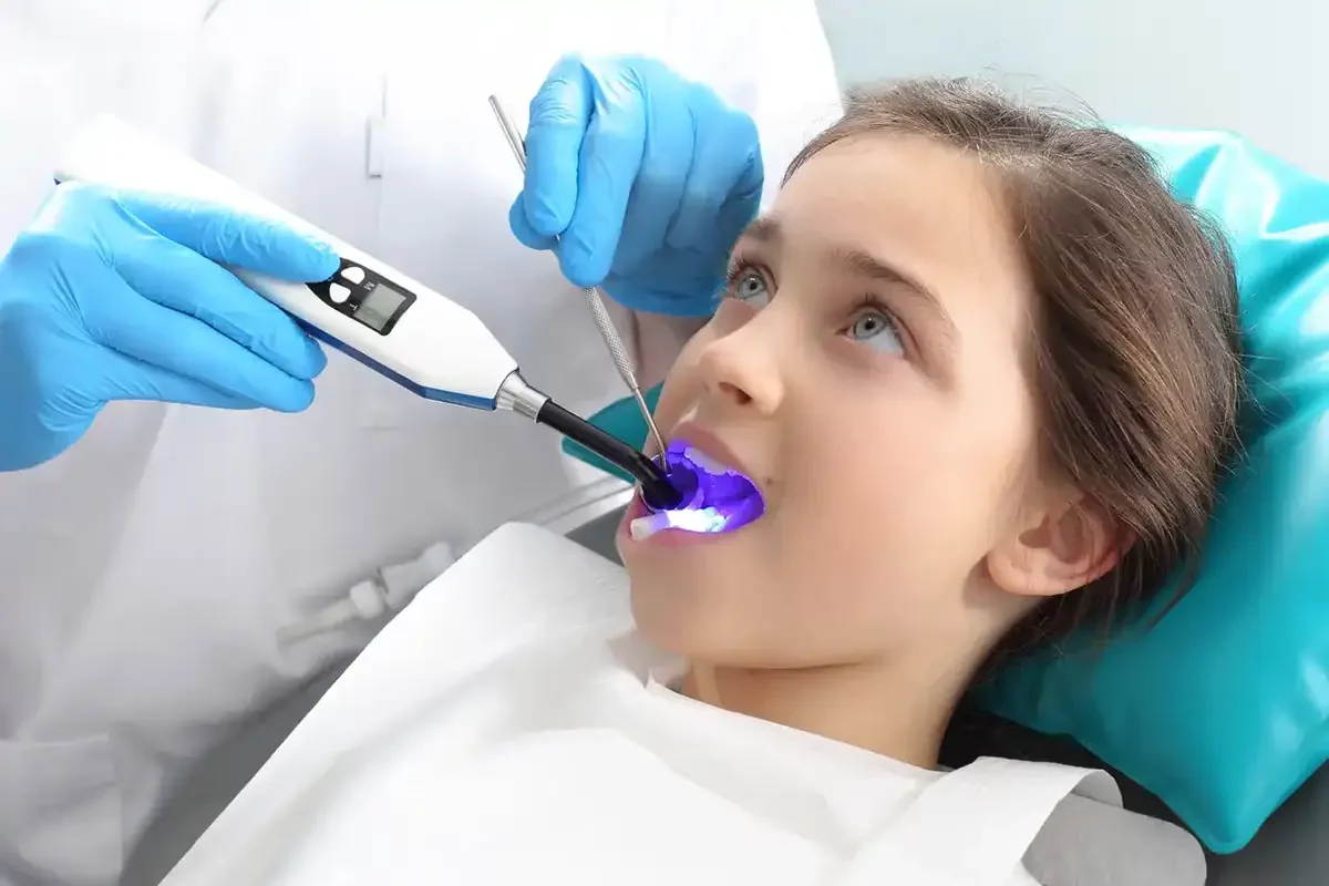 The Power Of Dental Sealants