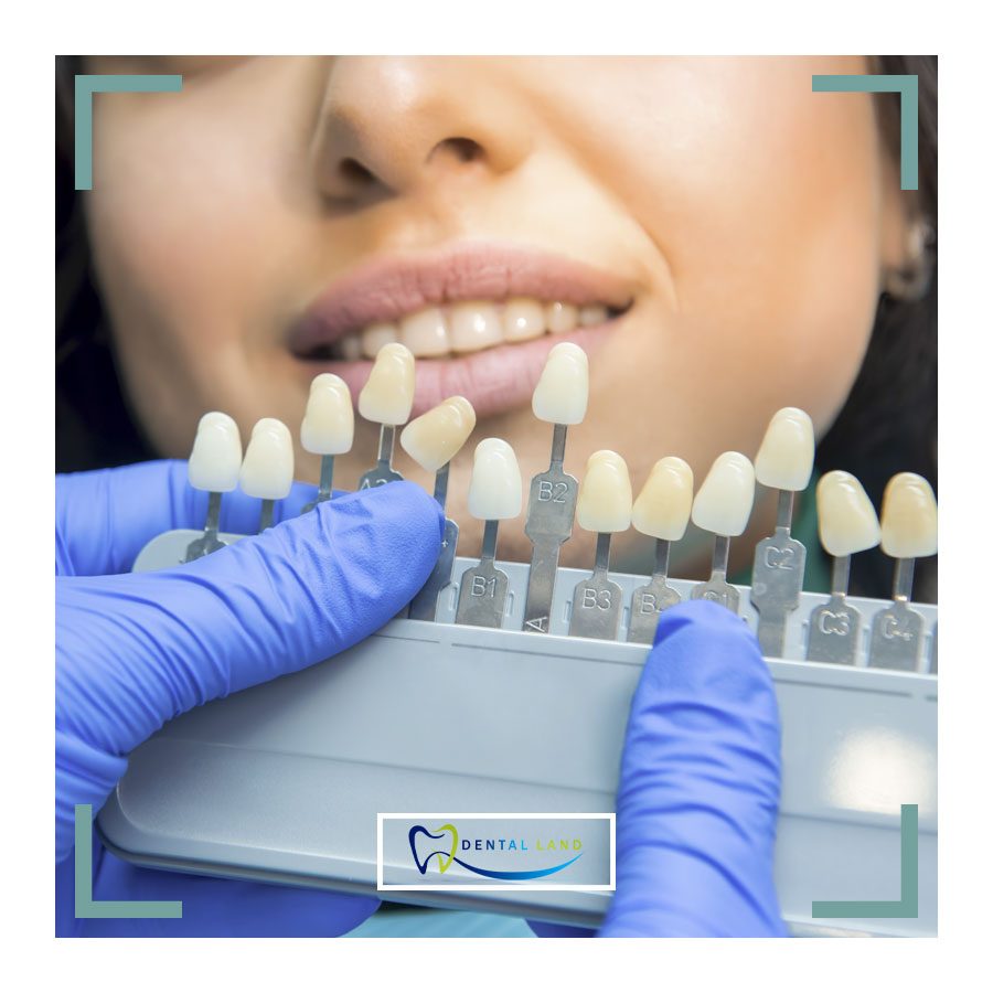 A dentist holding a tray of dental veneers to choose the right color for the patient who is ready for oral care