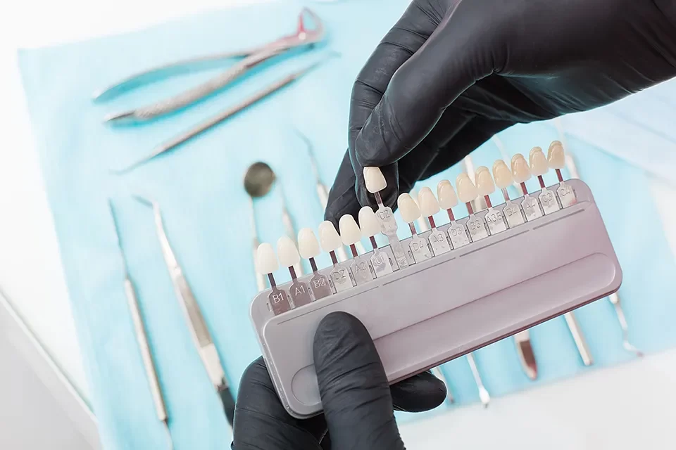 Dental Crowns Types of Dental Crown Materials