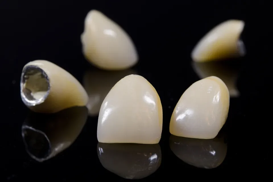 Dental Crowns-04