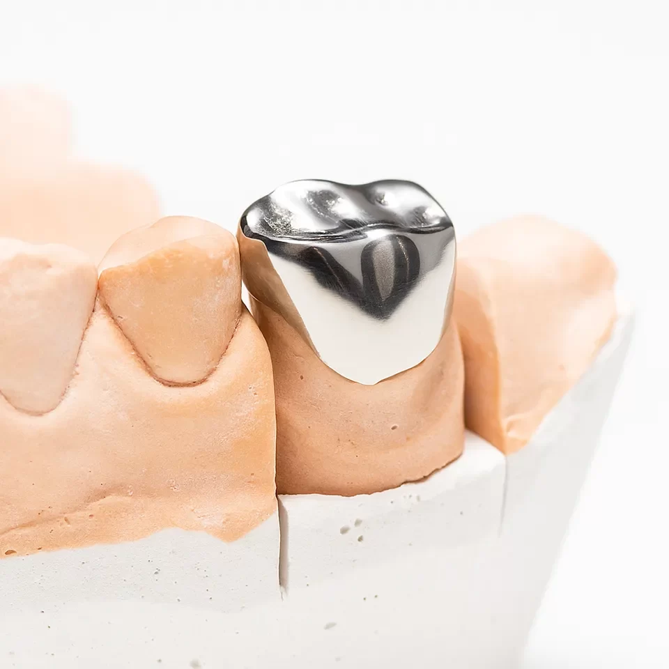 Dental Crowns Dental Crowns