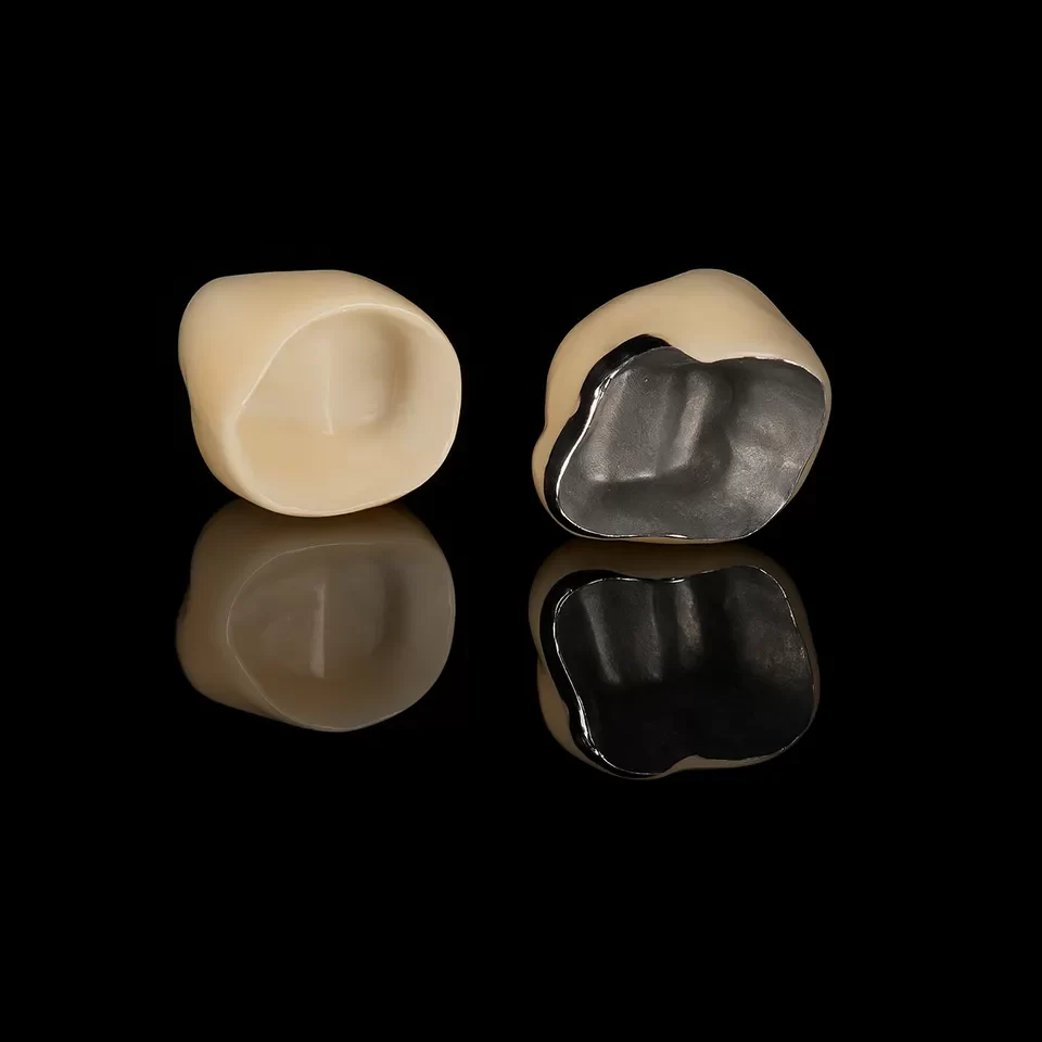 Dental Crowns Dental Crowns