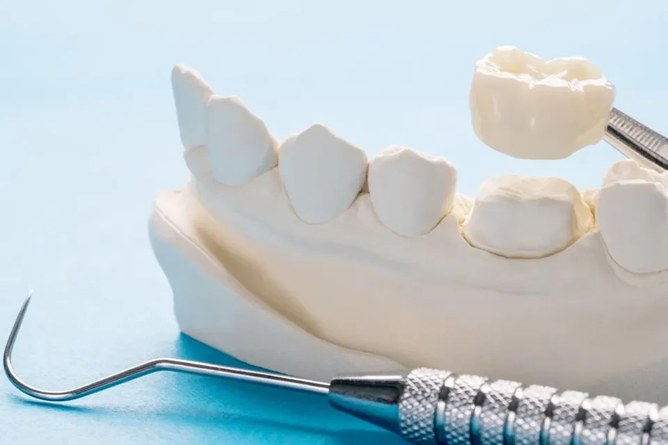 Dental Crowns-06