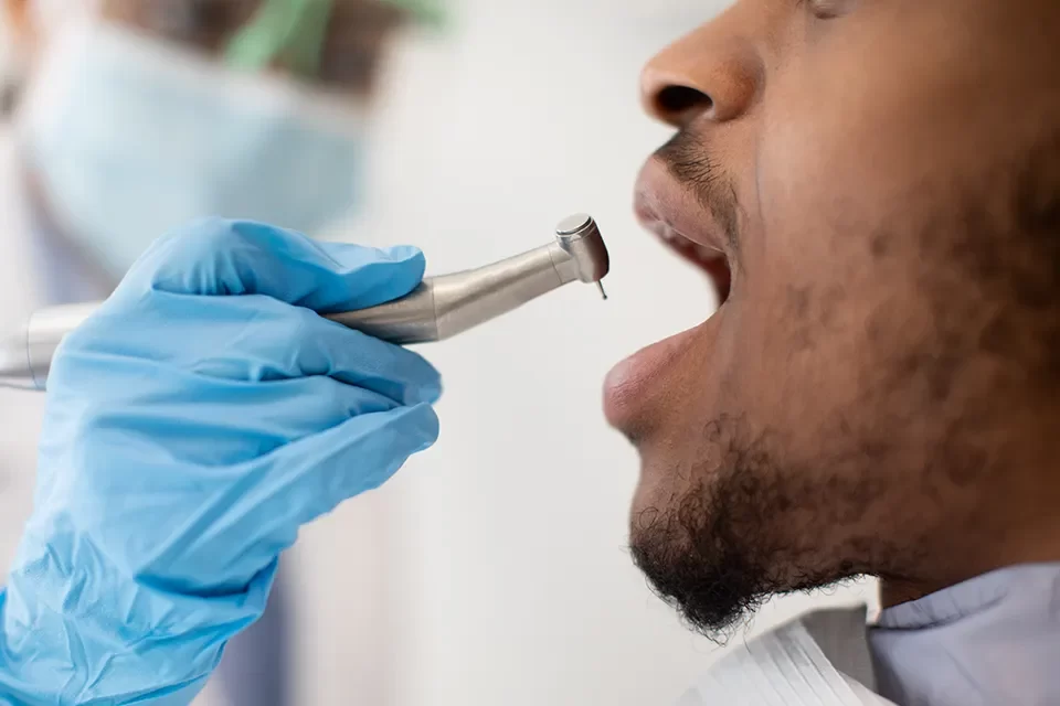 Dental Procedure The Dental Nerve Treatment Process