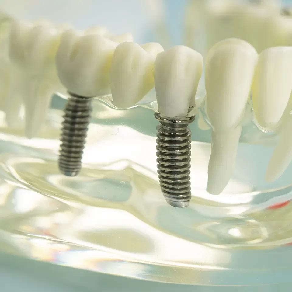 Denture Treatment Denture Treatment