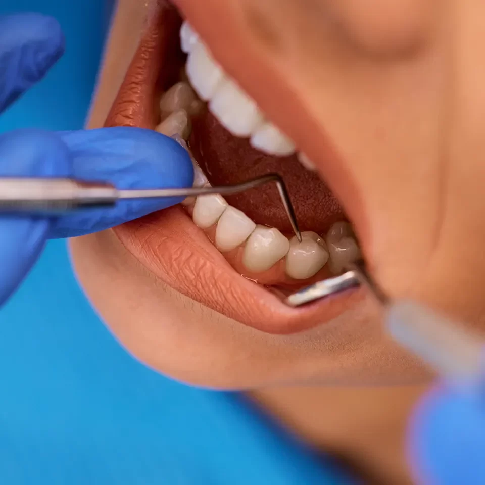 Endodontics Endodontics