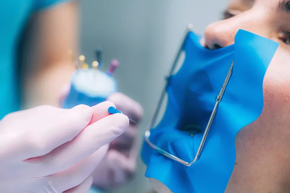 Gentle Root Canal Treatment in Toronto