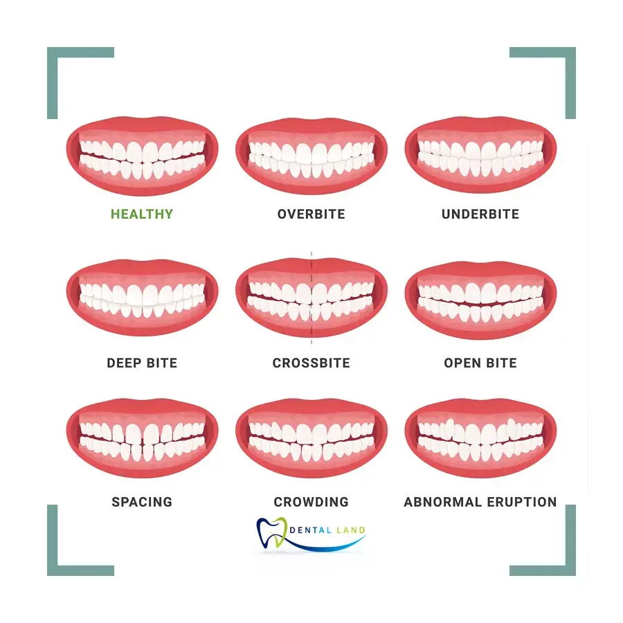 A visual representation of various teeth found in the mouth, including incisors, canines, premolars, and molars
