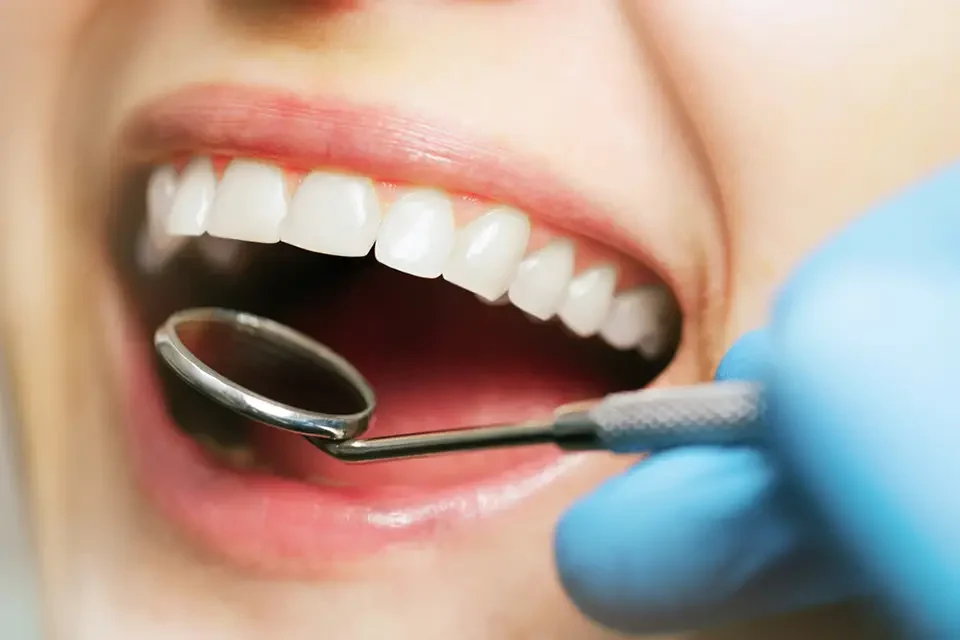 What to Expect During an Oral Health Checkup?