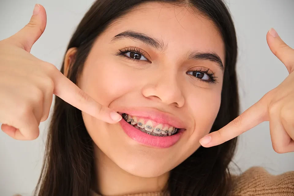 Benefits of Orthodontic Treatment for Crooked Teeth
