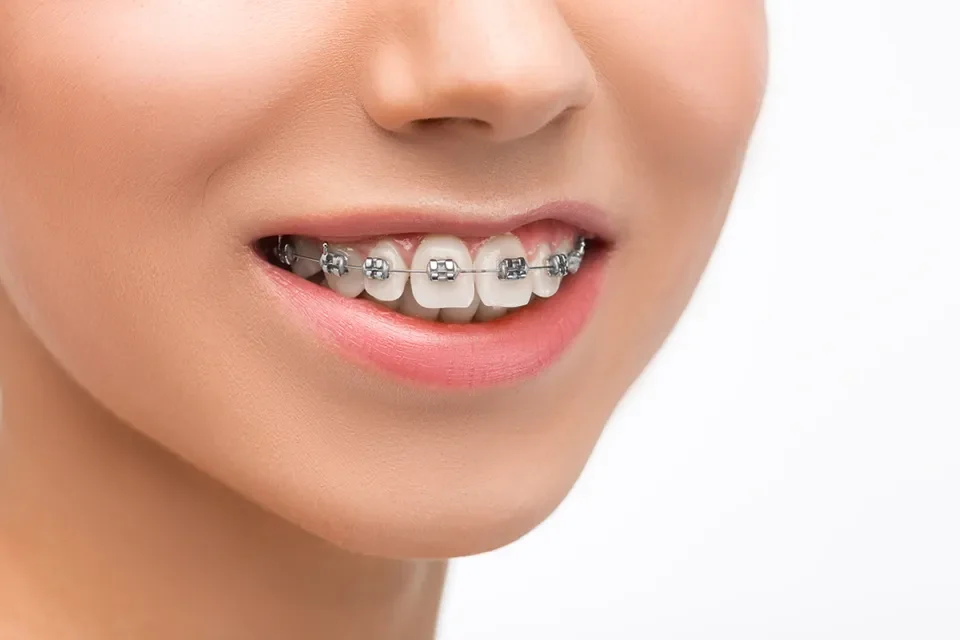 Orthodontics-01