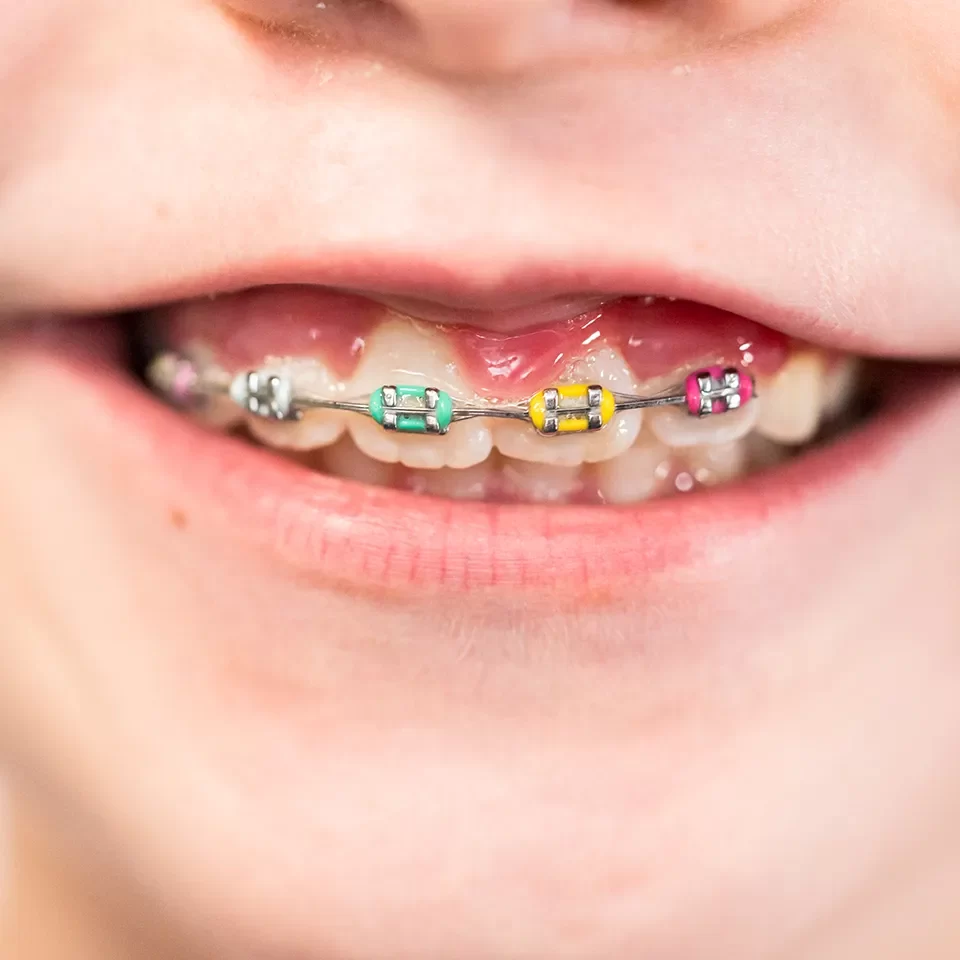 Orthodontics Orthodontics