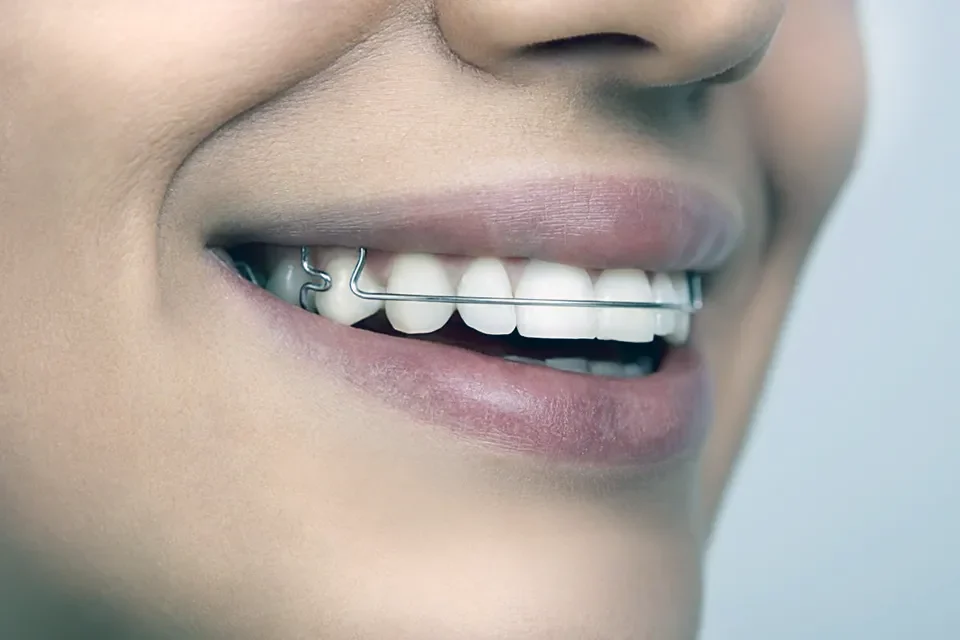 Orthodontics-07