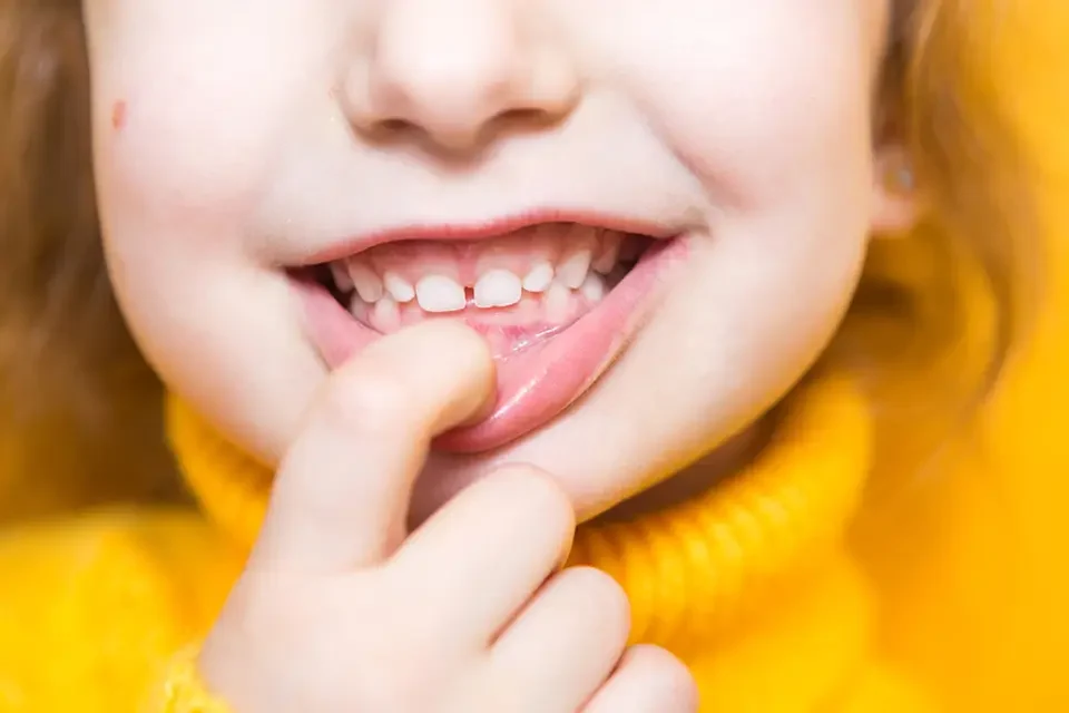 The Importance of Children's Dental Care