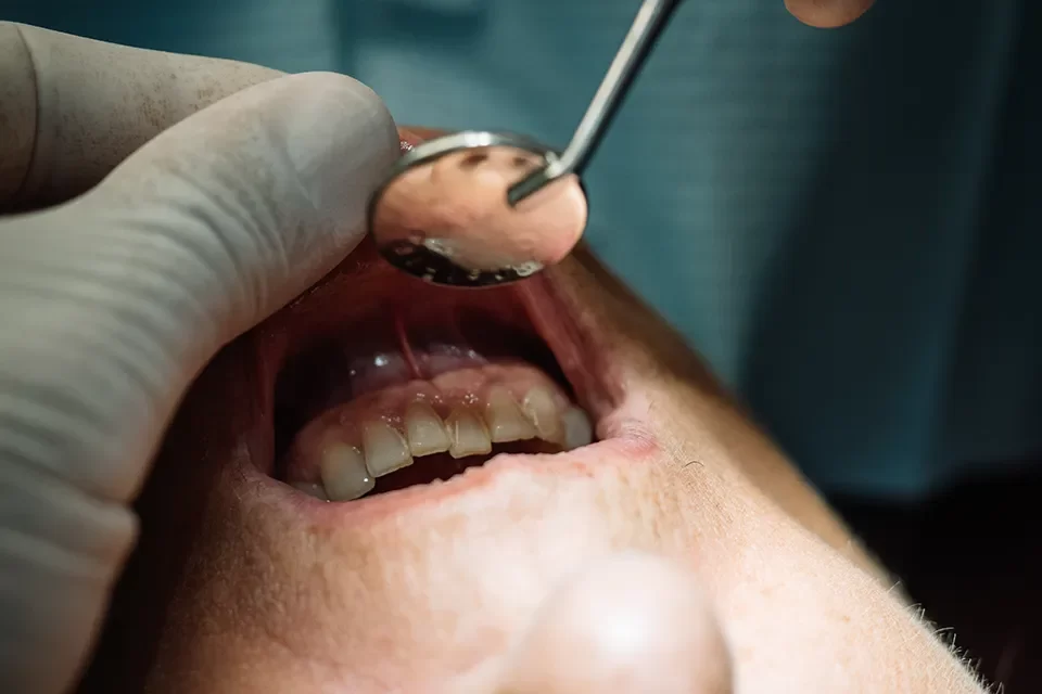 Gum Disease Key Strategies for Preventing Gum Infections