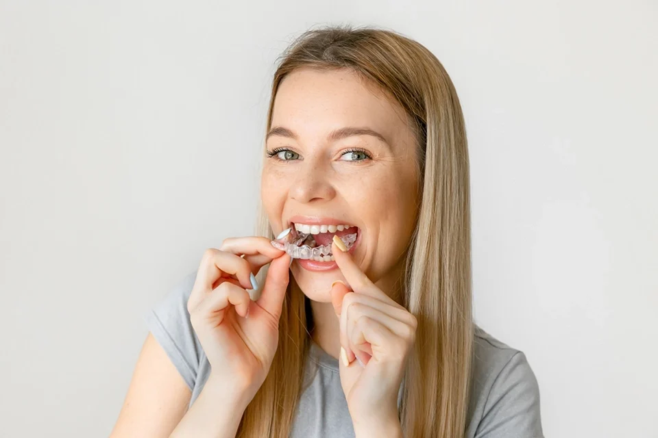 How Long Should You Wear Retainers After Orthodontic Braces?