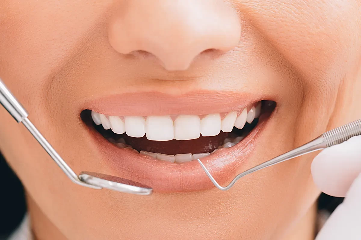 Root Planing in Toronto