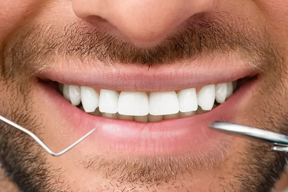 Dental Exam Why Regular Dental Checkups Matter