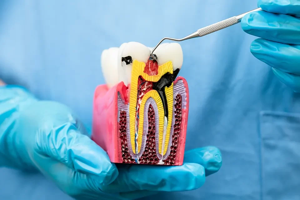 Stress & Dental Health in Summerhill, Toronto