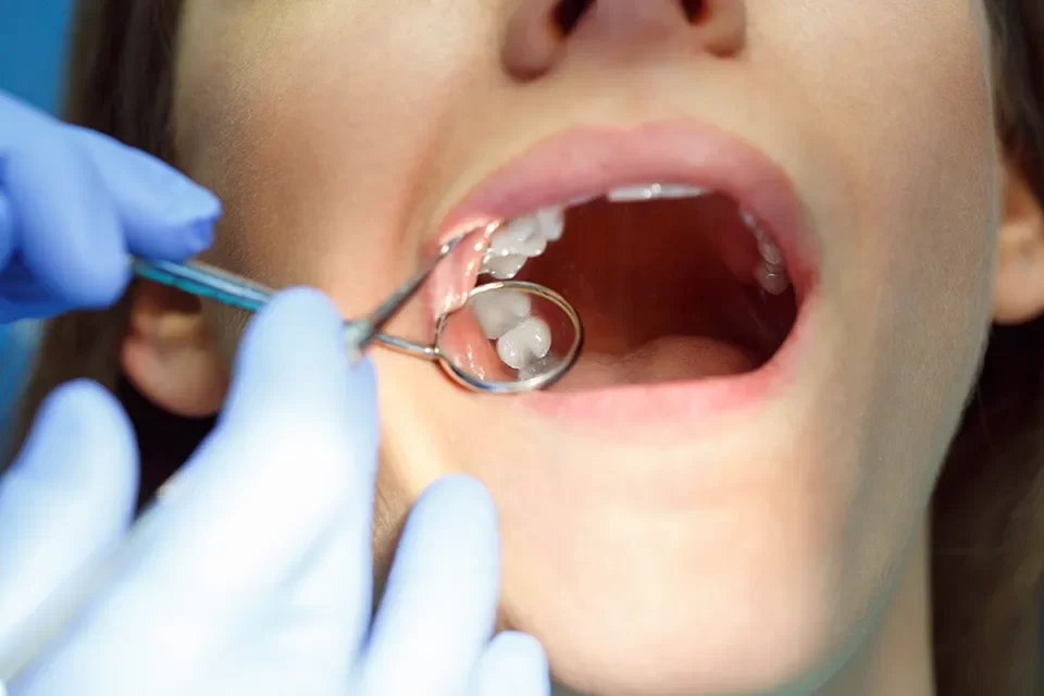 Less Common Tooth Extraction Complications