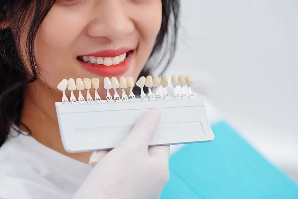 In summary, there are several types of dental bridges to consider when replacing missing teeth. Each option has advantages based on oral health, the number of teeth you must replace, and your preferences. Dental bridges can improve the appearance and functionality of your smile, so they are a worthwhile restoration option. Which Type of Dental Bridge Is Right for You?