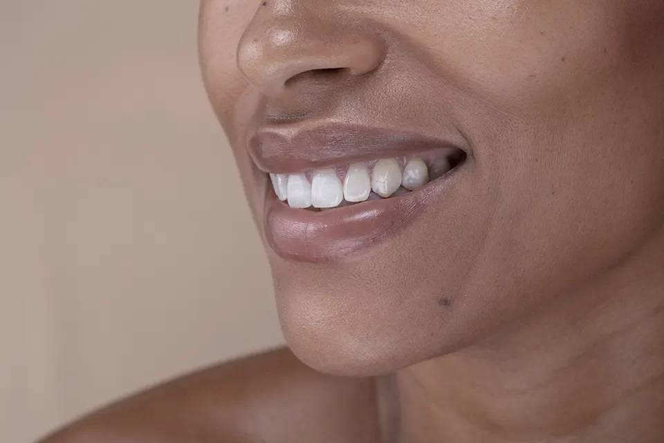 How to Choose the Right Type of Dental Implant