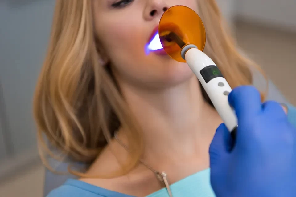 Dental Bonding