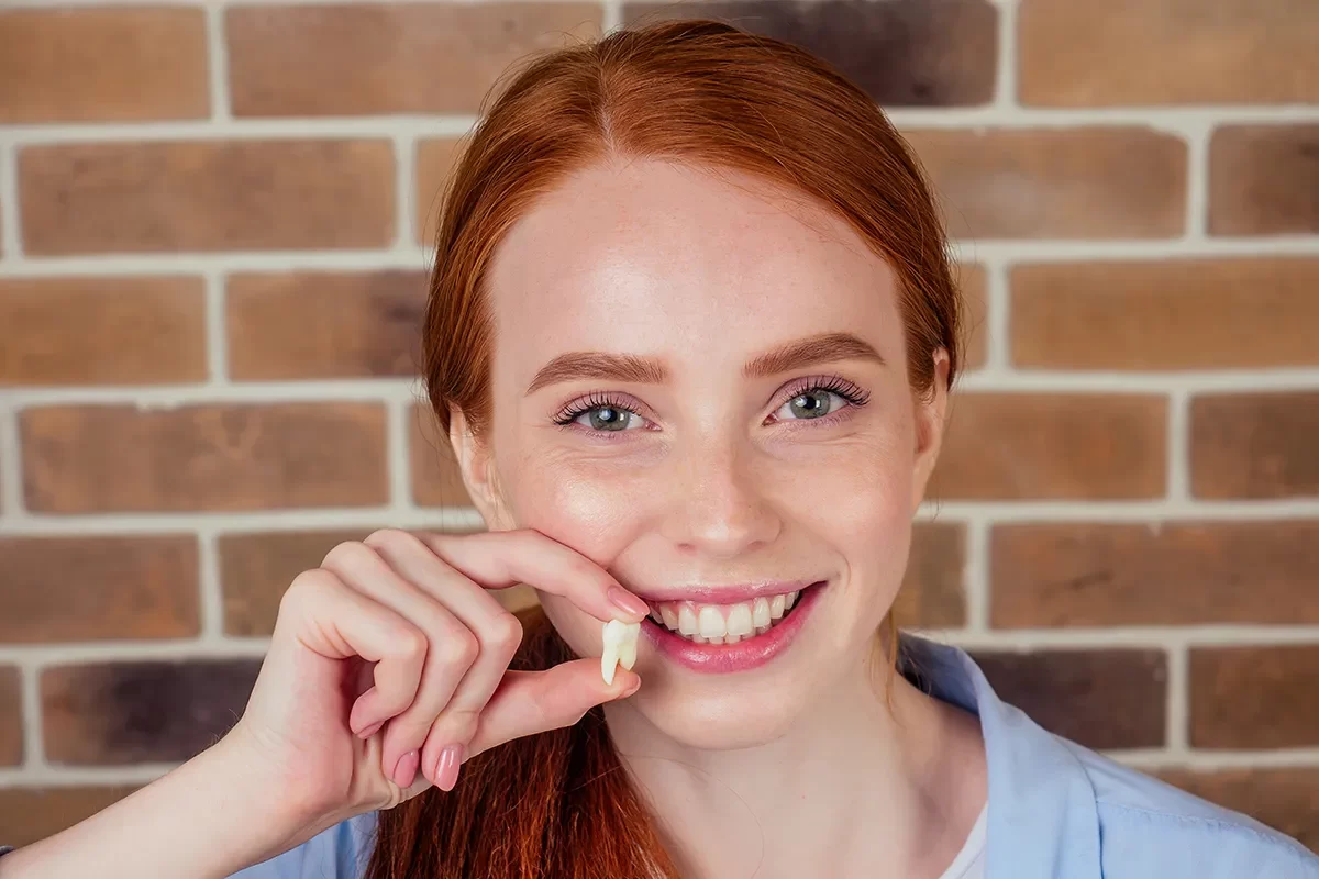 Wisdom Teeth Removal