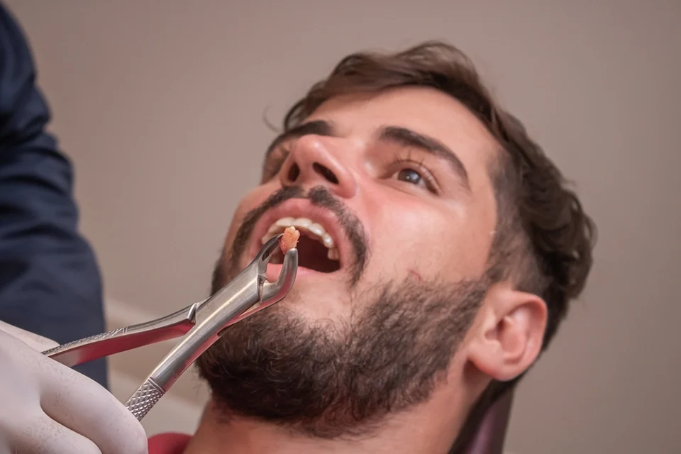 When Should Wisdom Teeth Be Removed? Key Timelines