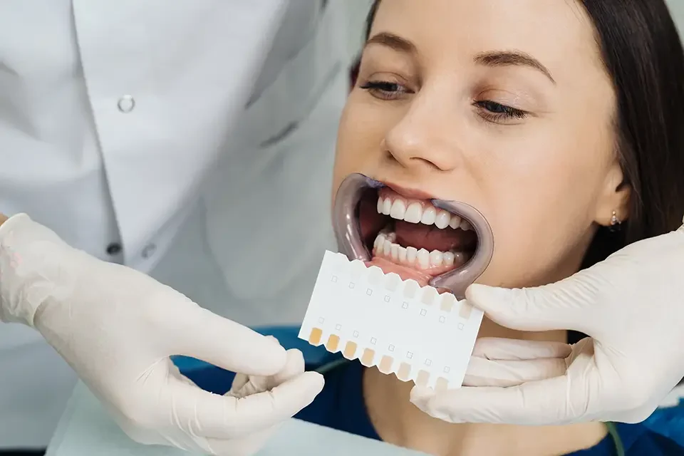 What Are the Disadvantages of Porcelain Veneers? — Irreversibility of the Procedure