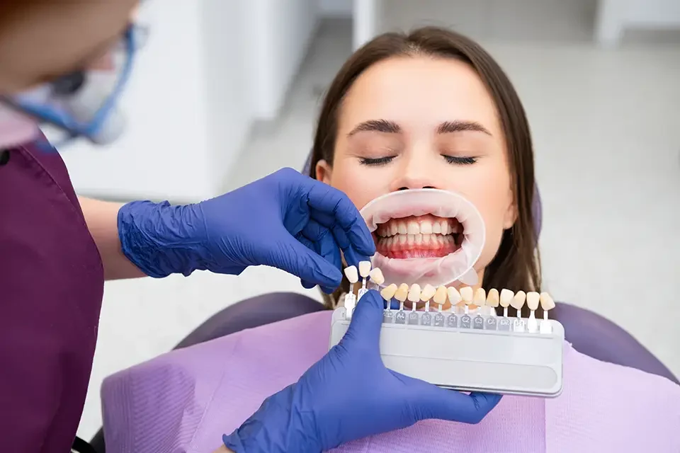 How to Take Care of Porcelain Veneers at Mealtimes: Foods and Habits to Avoid