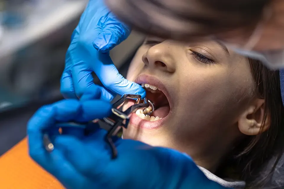 Third Molar Extraction: Costs, Time Off, and Practical Planning