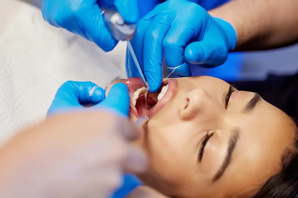 Third Molar Extraction: Why Timing Matters More Than You Think