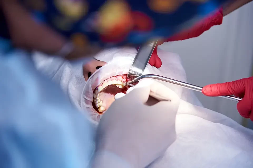 surgical-dentistry