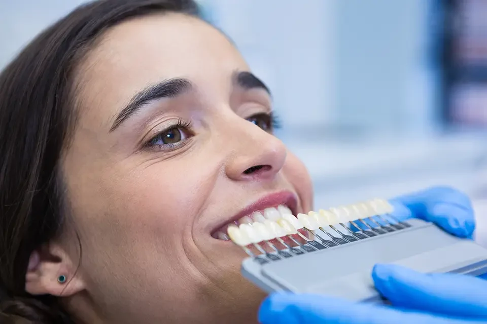veneer process How Long Do Porcelain Veneers Last: Average Lifespan